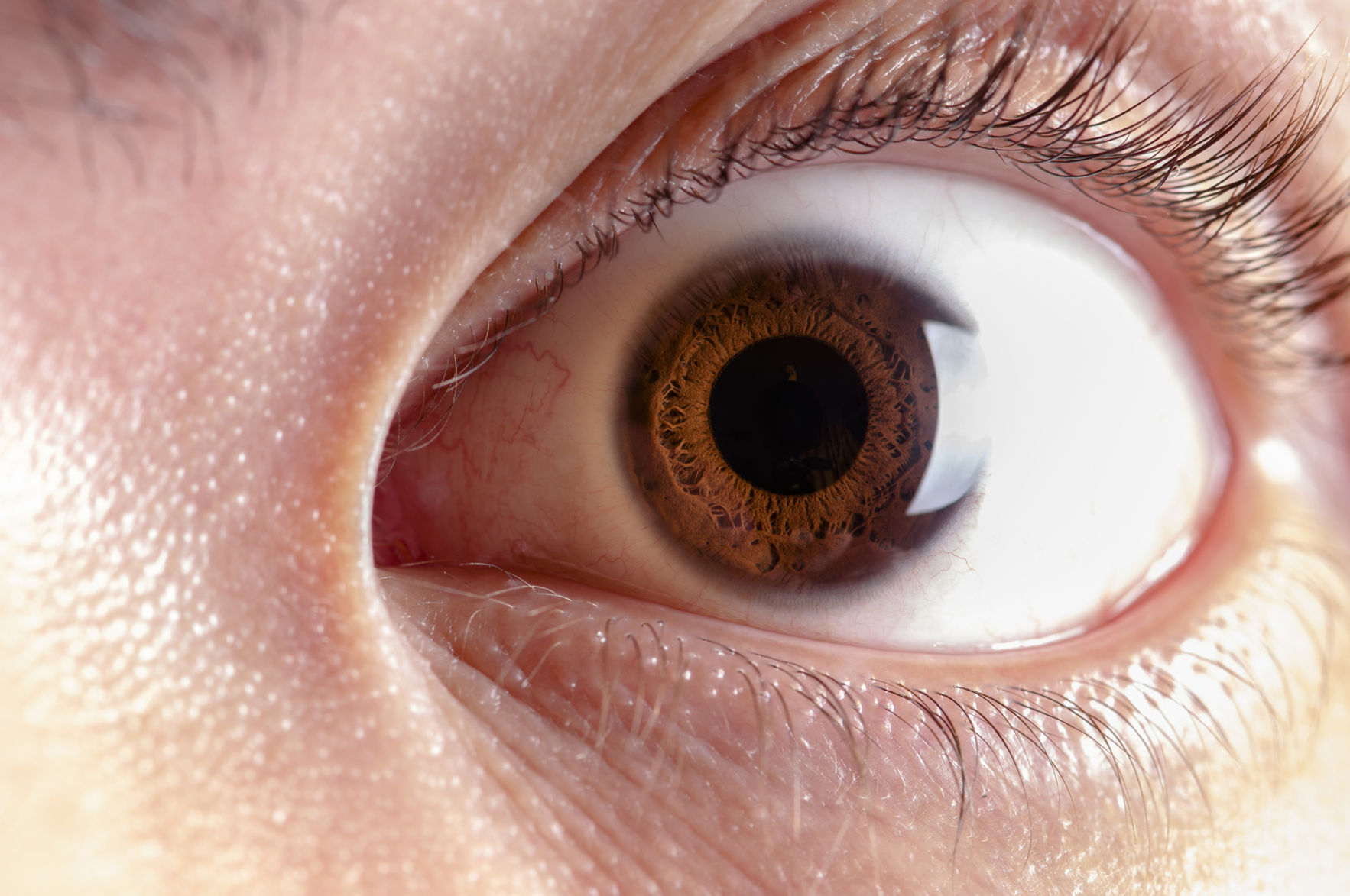 3D-printed corneas